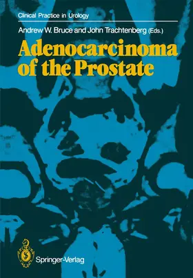 Bruce / Trachtenberg |  Adenocarcinoma of the Prostate | Buch |  Sack Fachmedien
