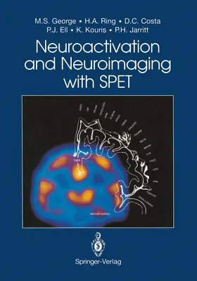George / Ring / Costa |  Neuroactivation and Neuroimaging with SPET | Buch |  Sack Fachmedien