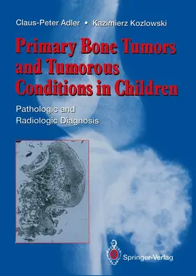 Adler / Kozlowski |  Primary Bone Tumors and Tumorous Conditions in Children | Buch |  Sack Fachmedien