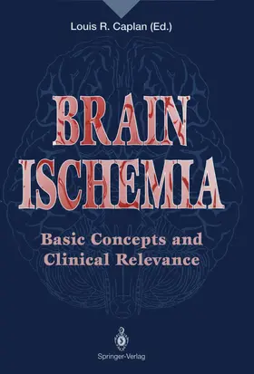 Caplan | Brain Ischemia | Buch | 978-1-4471-2075-9 | www.sack.de