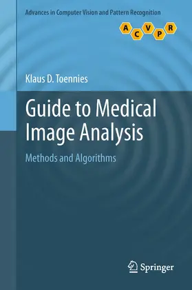 Toennies |  Guide to Medical Image Analysis | eBook | Sack Fachmedien