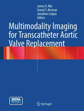 Min / Berman / Leipsic |  Multimodality Imaging for Transcatheter Aortic Valve Replacement | Buch |  Sack Fachmedien
