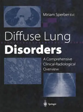 Sperber | Diffuse Lung Disorders | E-Book | www.sack.de