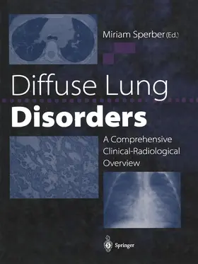 Sperber | Diffuse Lung Disorders | Buch | 978-1-4471-3442-8 | www.sack.de
