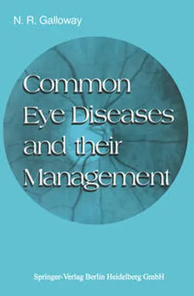 Galloway |  Common Eye Diseases and Their Management | eBook | Sack Fachmedien