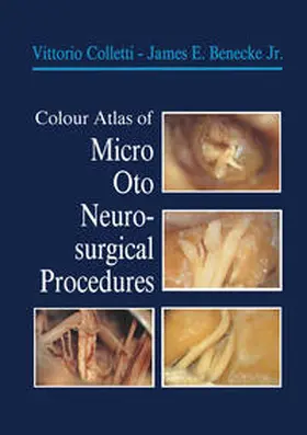 Colletti / Benecke | Colour Atlas of Micro-Oto-Neurosurgical Procedures | E-Book | www.sack.de
