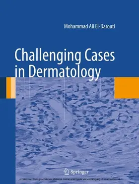 El-Darouti | Challenging Cases in Dermatology | E-Book | www.sack.de