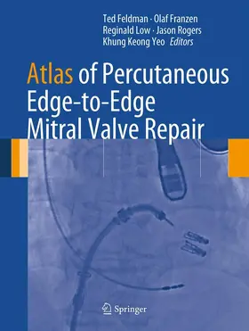 Feldman / Franzen / Low |  Atlas of Percutaneous Edge-to-Edge Mitral Valve Repair | eBook | Sack Fachmedien