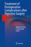 Cuesta / Bonjer |  Treatment of Postoperative Complications After Digestive Surgery | eBook | Sack Fachmedien