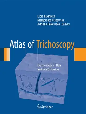 Rudnicka / Olszewska / Rakowska |  Atlas of Trichoscopy | Buch |  Sack Fachmedien