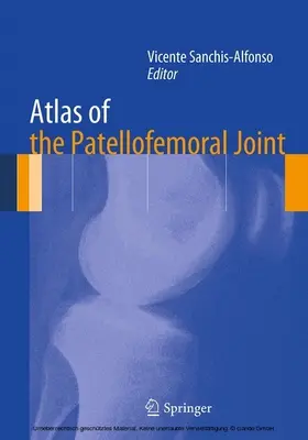 Sanchis-Alfonso | Atlas of the Patellofemoral Joint | E-Book | www.sack.de