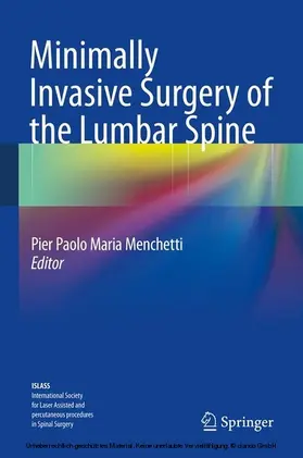 Menchetti |  Minimally Invasive Surgery of the Lumbar Spine | eBook | Sack Fachmedien