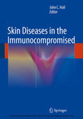 Hall |  Skin Diseases in the Immunocompromised | eBook | Sack Fachmedien