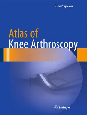 Prejbeanu |  Atlas of Knee Arthroscopy | Buch |  Sack Fachmedien