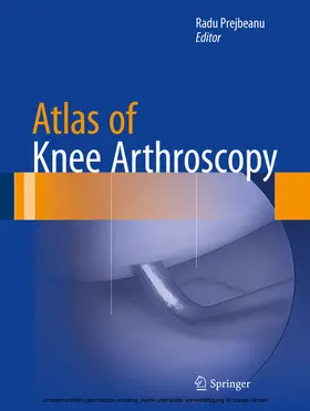Prejbeanu | Atlas of Knee Arthroscopy | E-Book | www.sack.de