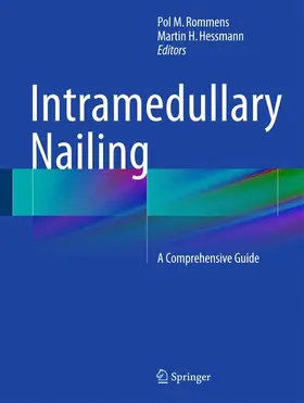 Rommens / Hessmann |  Intramedullary Nailing | Buch |  Sack Fachmedien