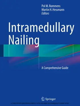 Rommens / Hessmann | Intramedullary Nailing | E-Book | www.sack.de
