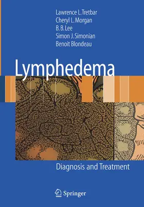 Tretbar / Morgan / Blondeau |  Lymphedema | Buch |  Sack Fachmedien