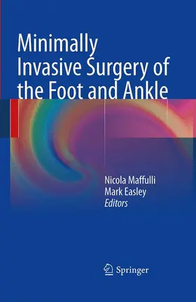 Maffulli / Easley |  Minimally Invasive Surgery of the Foot and Ankle | Buch |  Sack Fachmedien