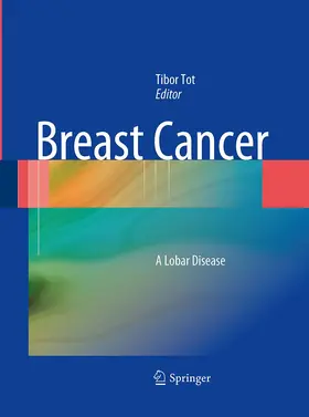 Tot |  Breast Cancer | Buch |  Sack Fachmedien