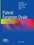 Amin / Carroll / Tobis |  Patent Foramen Ovale | Buch |  Sack Fachmedien