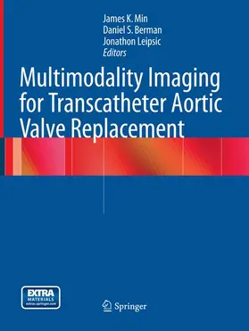 Min / Berman / Leipsic |  Multimodality Imaging for Transcatheter Aortic Valve Replacement | Buch |  Sack Fachmedien