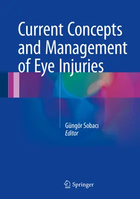 Sobaci / Sobaci |  Current Concepts and Management of Eye Injuries | eBook | Sack Fachmedien