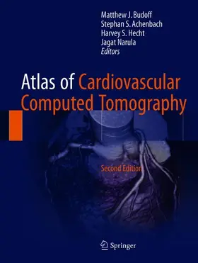 Budoff / Achenbach / Hecht |  Atlas of Cardiovascular Computed Tomography | Buch |  Sack Fachmedien
