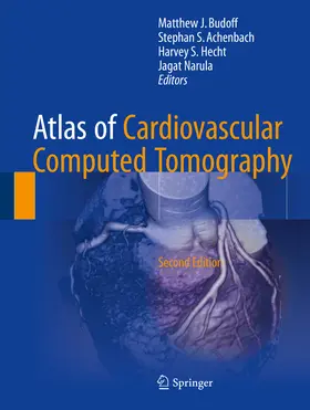 Budoff / Achenbach / Hecht |  Atlas of Cardiovascular Computed Tomography | eBook | Sack Fachmedien