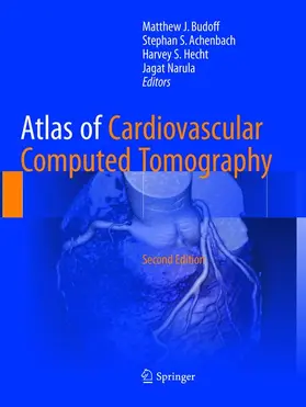 Budoff / Achenbach / Hecht |  Atlas of Cardiovascular Computed Tomography | Buch |  Sack Fachmedien
