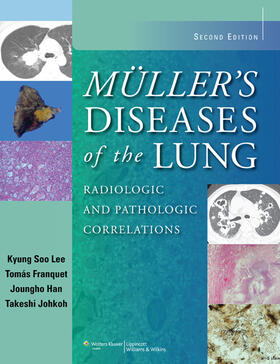 Lee / Franquet / Han | Muller's Diseases of the Lung: Radiologic and Pathologic Correlations | Buch | 978-1-4511-1116-3 | sack.de