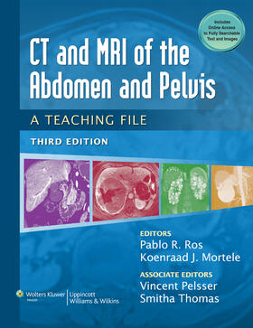 Ros / Mortele |  CT & MRI of the Abdomen and Pelvis | Buch |  Sack Fachmedien