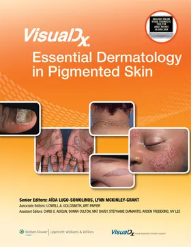 Goldsmith / Papier | VisualDx: Essential Dermatology in Pigmented Skin | Buch | 978-1-4511-1605-2 | sack.de