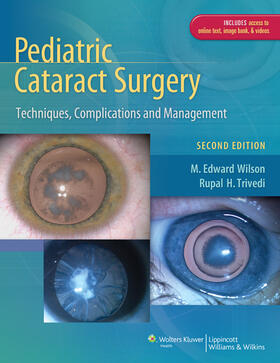 Wilson / Trivedi | Pediatric Cataract Surgery | Buch | 978-1-4511-4271-6 | sack.de