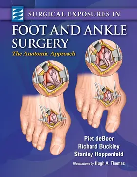 deBoer / Buckley / Hoppenfeld |  Surgical Exposures in Foot & Ankle Surgery | Buch |  Sack Fachmedien