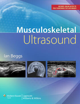 Beggs |  Beggs, D: Musculoskeletal Ultrasound | Buch |  Sack Fachmedien