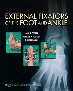 Cooper / Polyzois / Zgonis |  External Fixators of the Foot and Ankle | Buch |  Sack Fachmedien