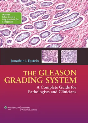 Epstein |  The Gleason Grading System | Buch |  Sack Fachmedien