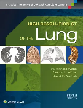 Webb / Muller / Naidich | High-Resolution CT of the Lung | Buch | 978-1-4511-7601-8 | sack.de