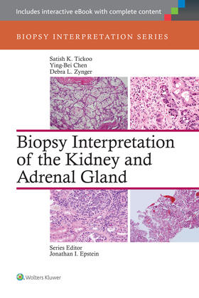 Tickoo / Chen / Zynger | Biopsy Interpretation of the Kidney & Adrenal Gland | Buch | 978-1-4511-7647-6 | sack.de