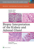 Tickoo / Chen / Zynger |  Biopsy Interpretation of the Kidney & Adrenal Gland | Buch |  Sack Fachmedien