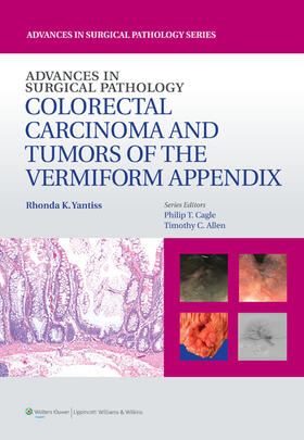 Yantiss | Advances in Surgical Pathology: Colorectal Carcinoma and Tumors of the Vermiform Appendix | Buch | 978-1-4511-8277-4 | sack.de
