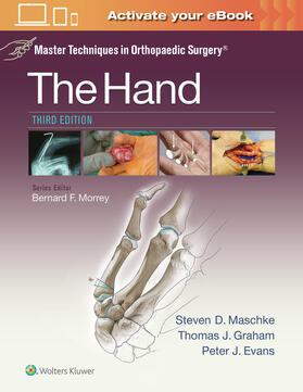 Maschke / Graham / Evans | Maschke, D: Master Techniques in Orthopaedic Surgery: The Ha | Buch | 978-1-4511-8278-1 | sack.de
