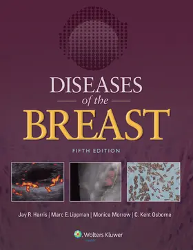 Harris / Lippman / Morrow |  Diseases of the Breast | Buch |  Sack Fachmedien