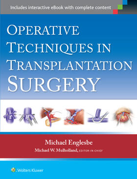 Englesbe | Operative Techniques in Transplantation Surgery | Buch | 978-1-4511-8874-5 | sack.de