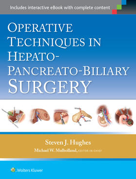 Hughes | Hughes, S: Operative Techniques in Hepato-Pancreato-Biliary | Buch | 978-1-4511-9019-9 | sack.de