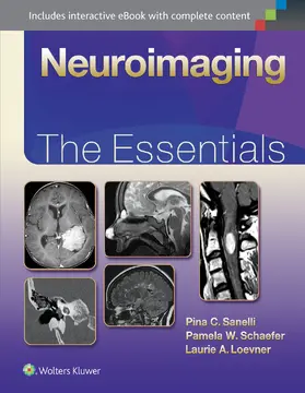 Sanelli / Schaefer / Loevner |  Neuroimaging | Buch |  Sack Fachmedien