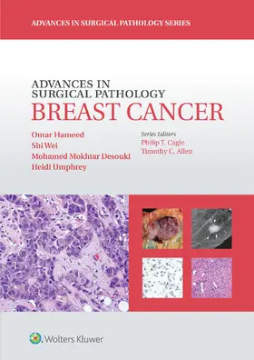 Hameed / Desouki / Umphrey |  Advances in Surgical Pathology: Breast Cancer | Buch |  Sack Fachmedien
