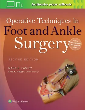Easley | Operative Techniques in Foot and Ankle Surgery | Buch | 978-1-4511-9368-8 | www.sack.de