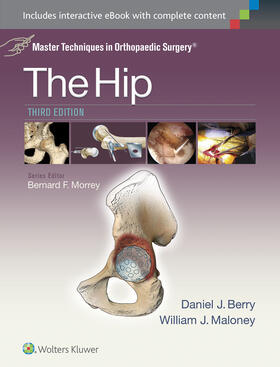 Berry / Maloney | Master Techniques in Orthopaedic Surgery: The Hip | Buch | 978-1-4511-9402-9 | sack.de